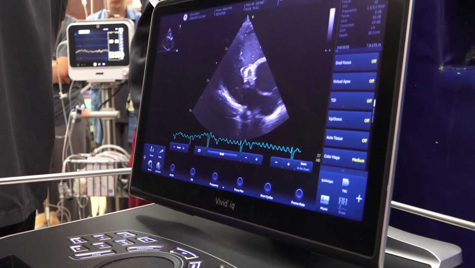 Treating Equine Atrial Fibrillation with Transvenous Electrical ...